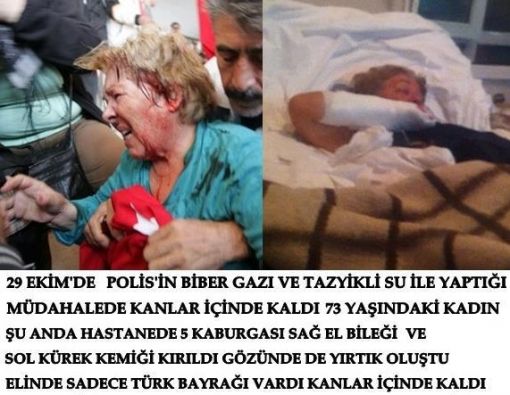 Polis binanın girişinden kaçmak zorunda kalmış.